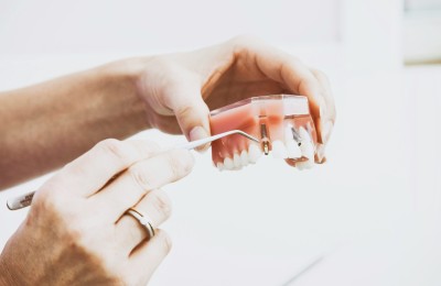 Targeting the Right Audience for Your Denture Services